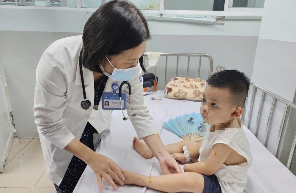 TP. Hồ Chí Minh: Báo động đỏ số ca mắc tay chân miệng