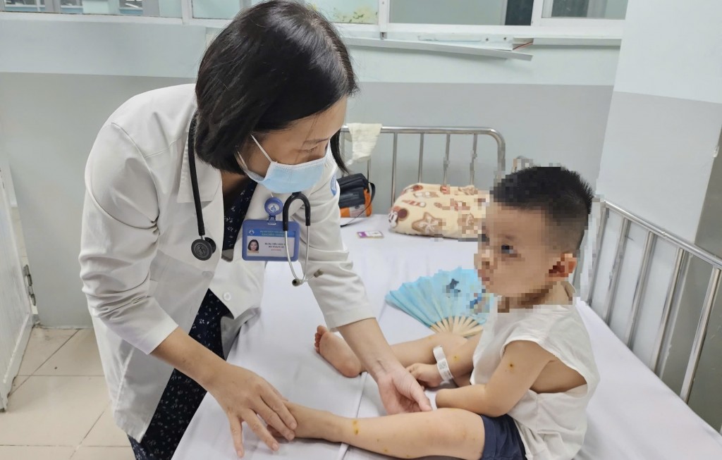 TP. Hồ Chí Minh: Báo động đỏ số ca mắc tay chân miệng TP. Hồ Chí Minh: Báo động đỏ số ca mắc tay chân miệng